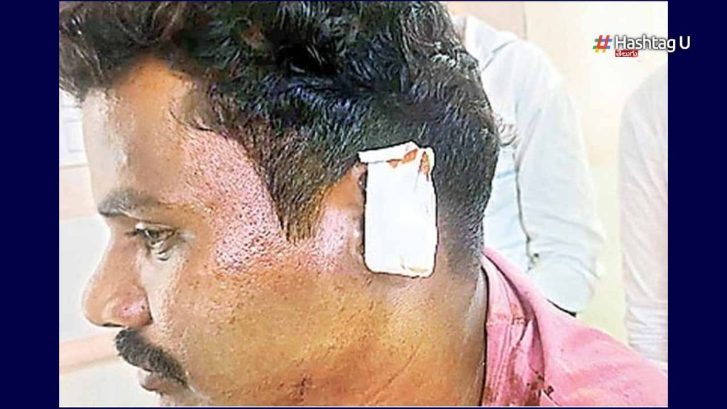 Ycp Leader Cuts Ear Of Tdp