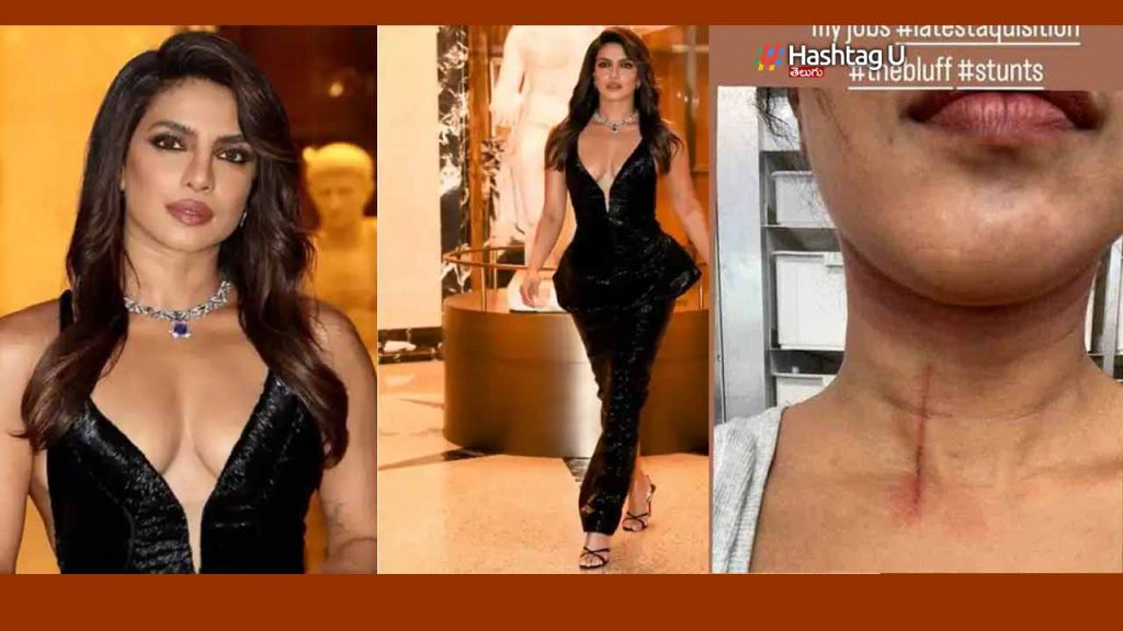 Priyanka Chopra Accident