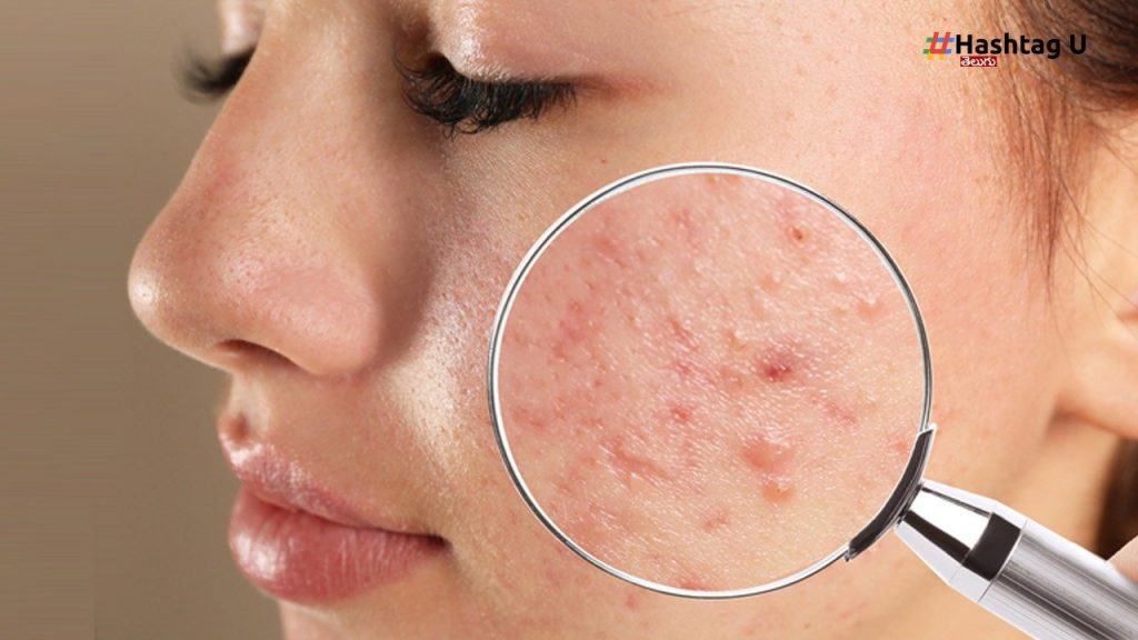 Skin Care