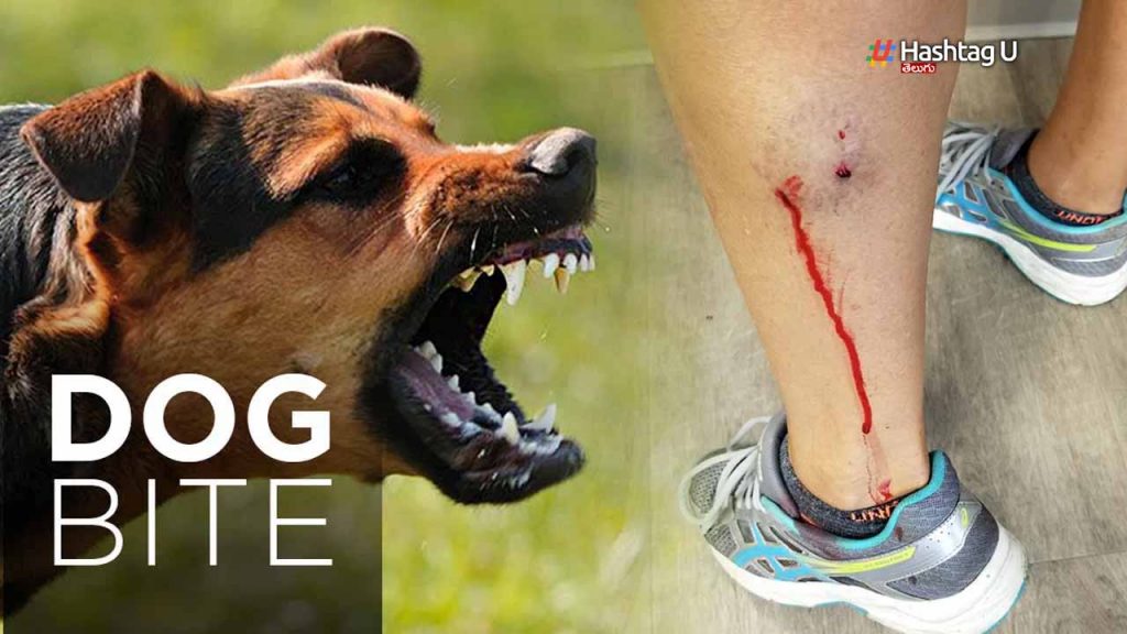 Dog Bite