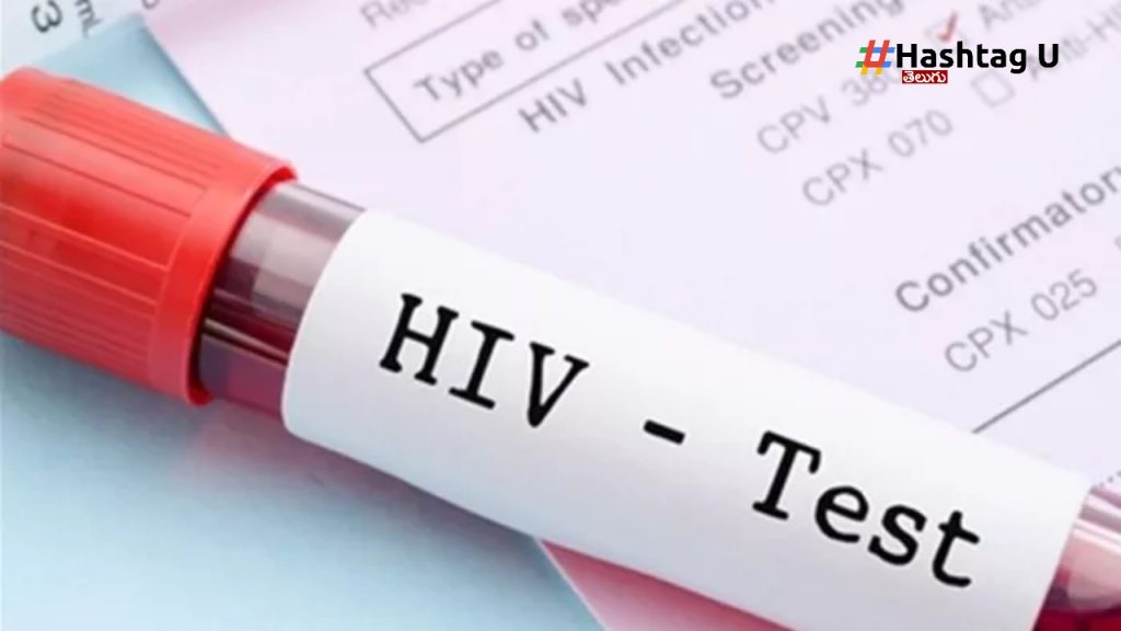 Hiv Test