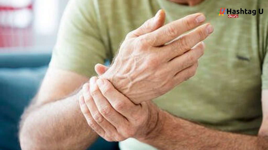 Arthritis (1)