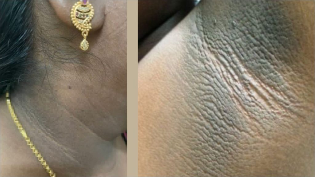 Black Neck