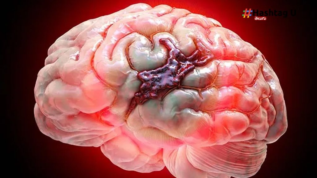 Brain (1)