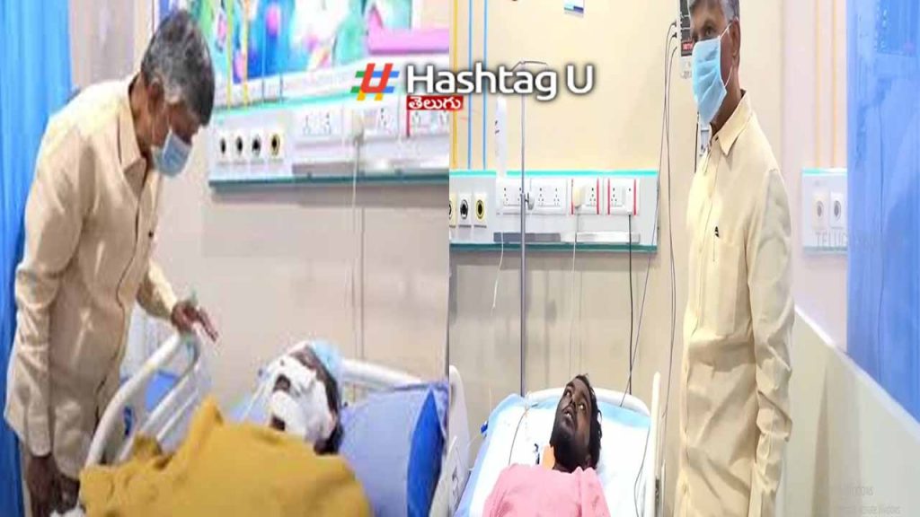 Cm Chandrababu Visits Achyu