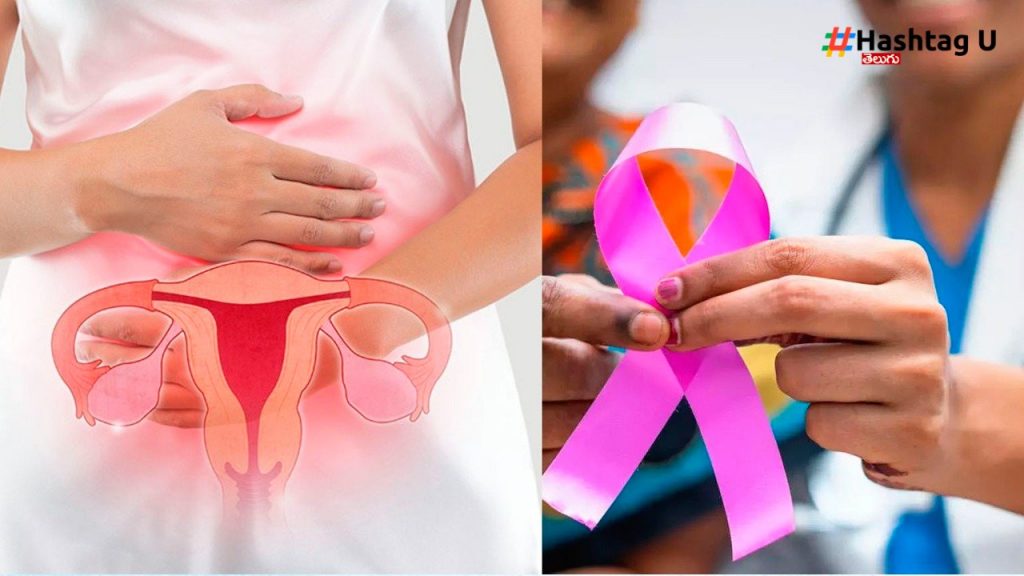 Cervical Cancer