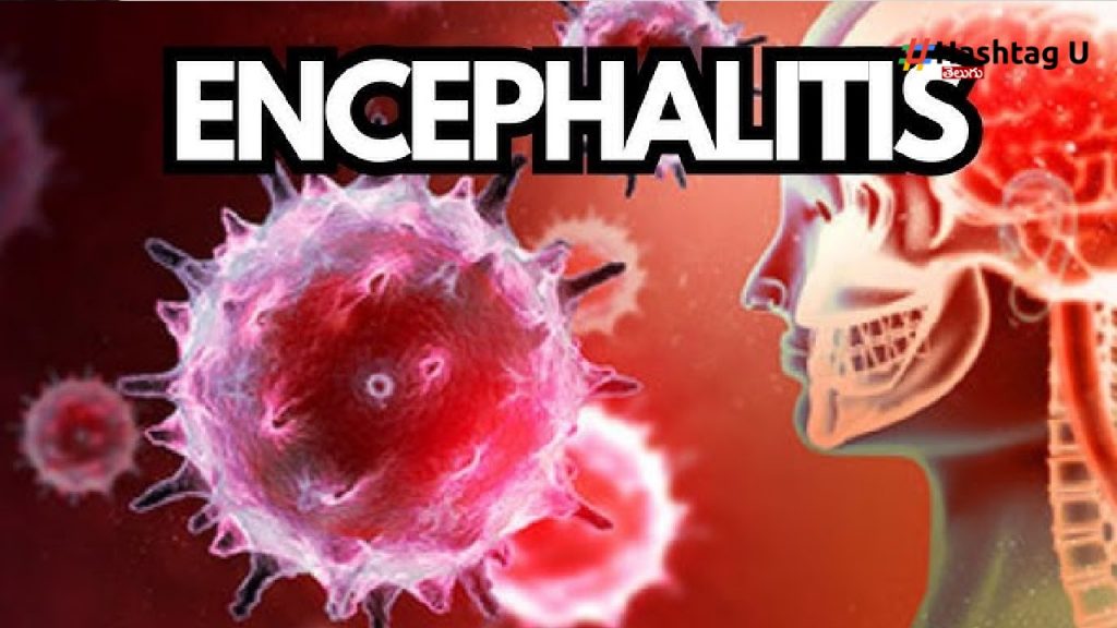 Encephalitis