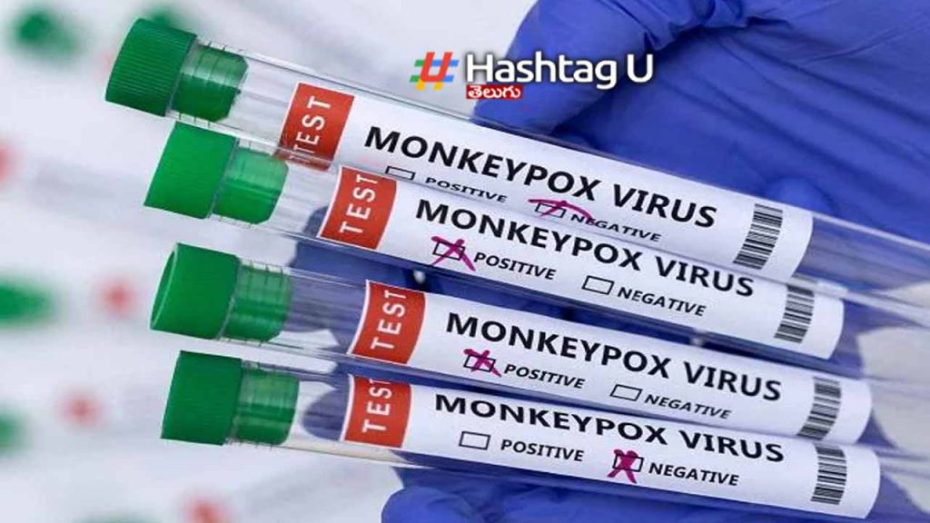 Monkeypox.. Third case registered in India