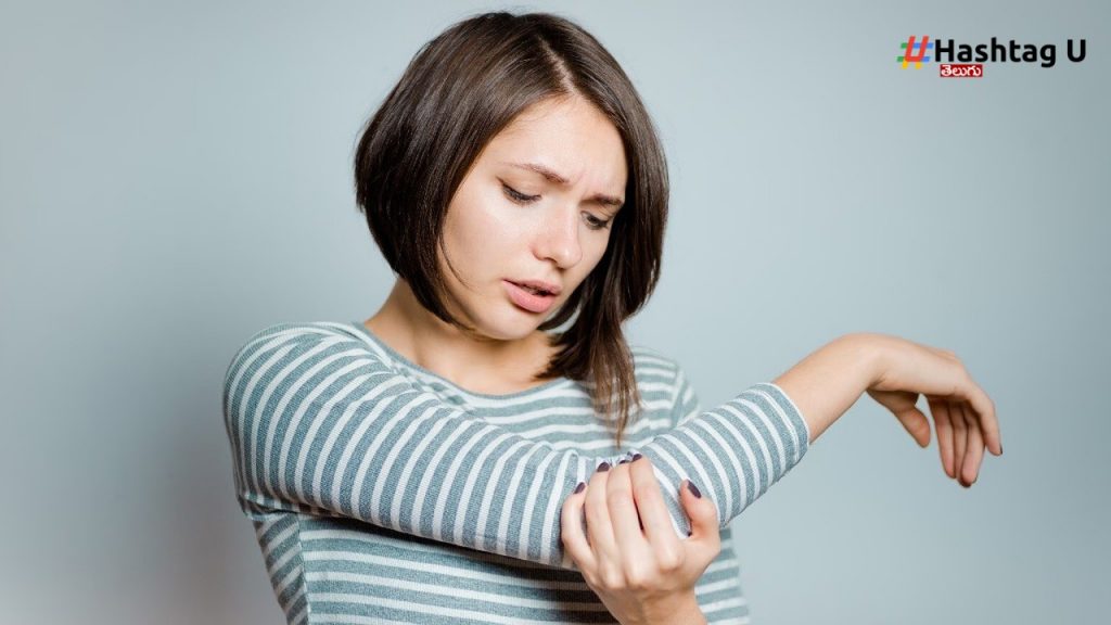 Arthritis (2)