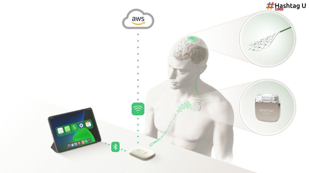 Brain Implant Control Amazons Alexa