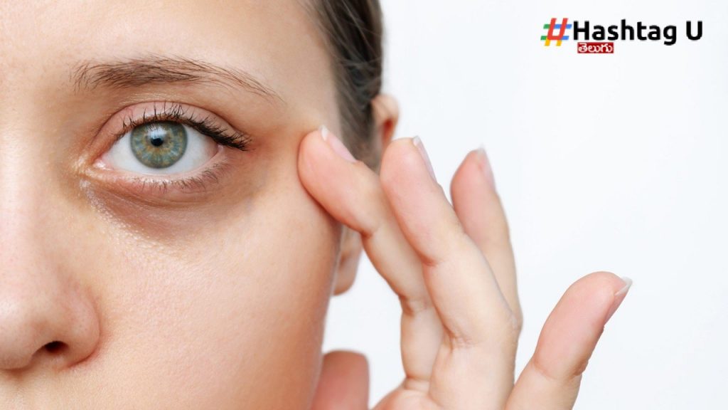 Dark Circles (1)