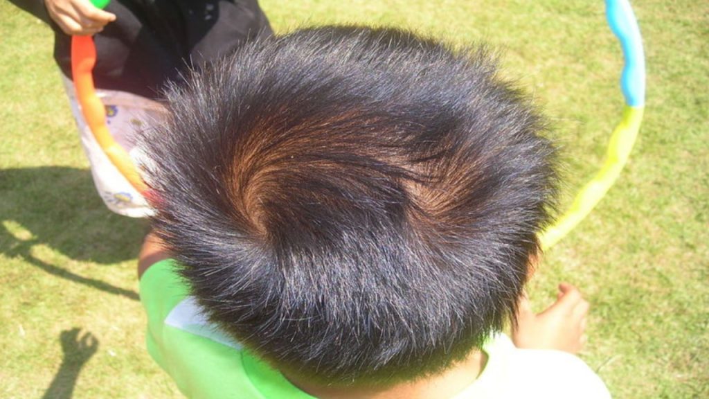 Double Whorl (2)