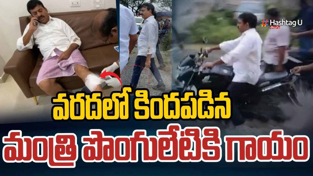 Minister Ponguleti Injured