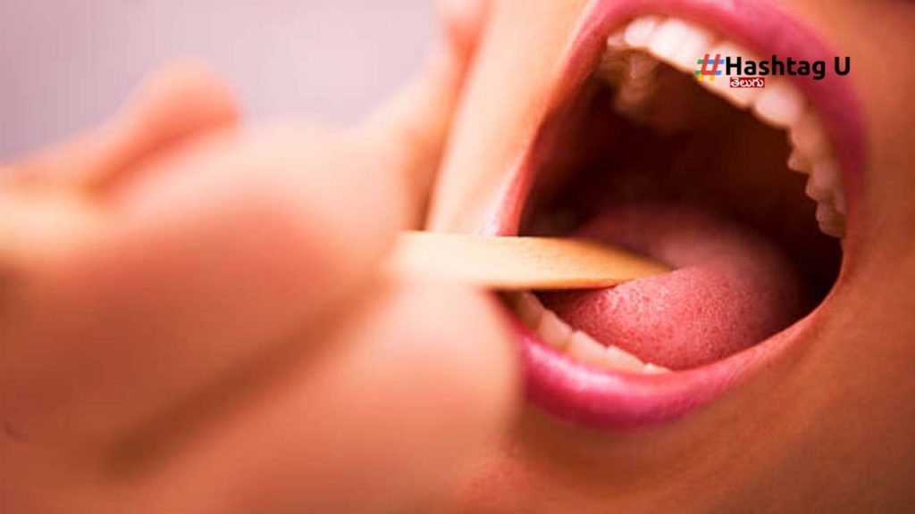 Tongue Color