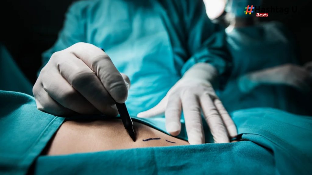 Surgery