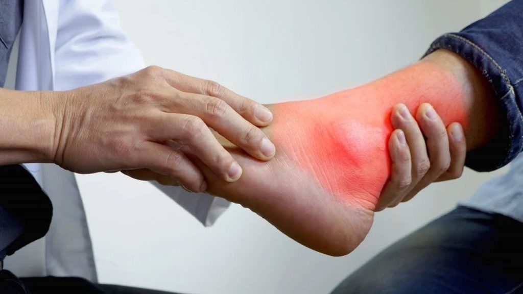 Uric Acid Tips