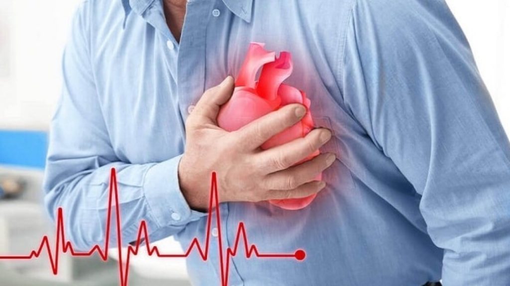 Heart Stroke