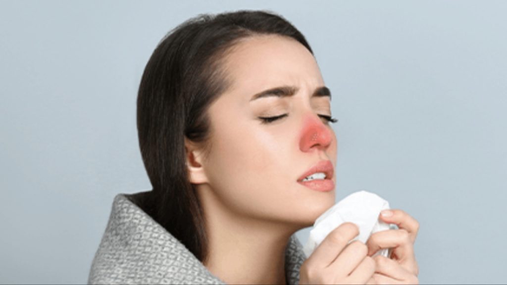 Nasal Congestion