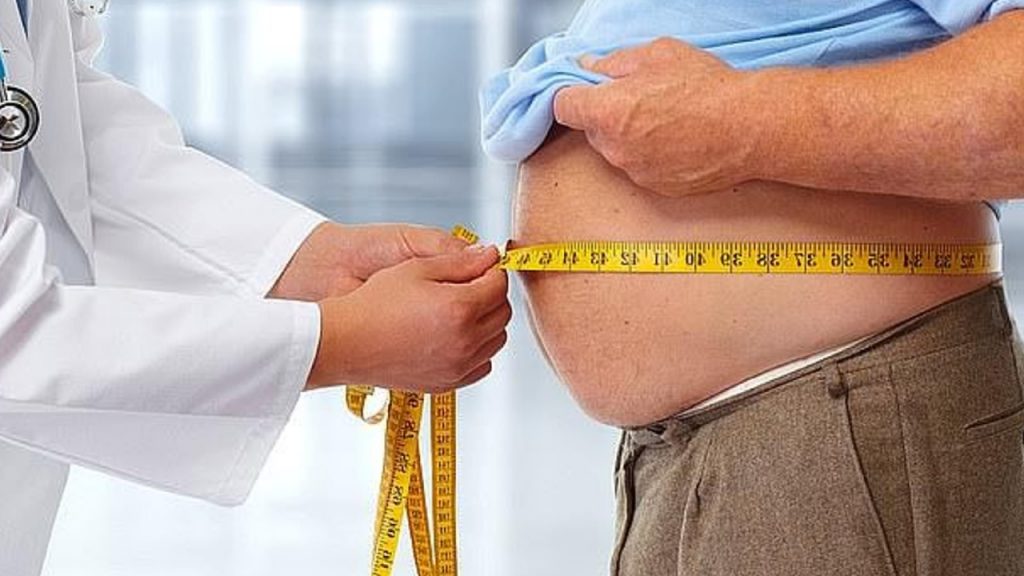 Obesity