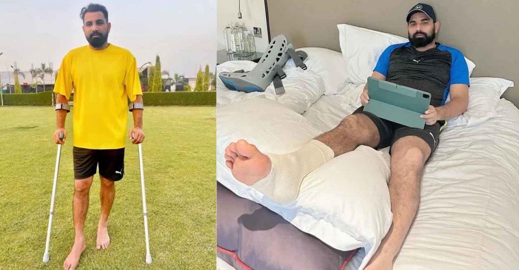 Shami Injury Update