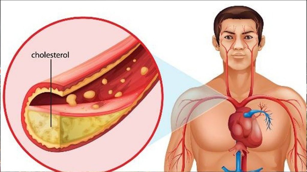 Cholesterol