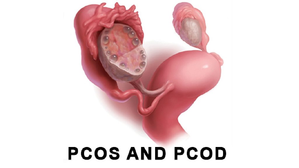 Pcod