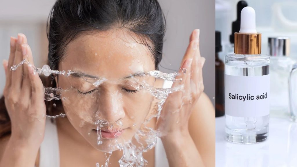 Salicylic Acid