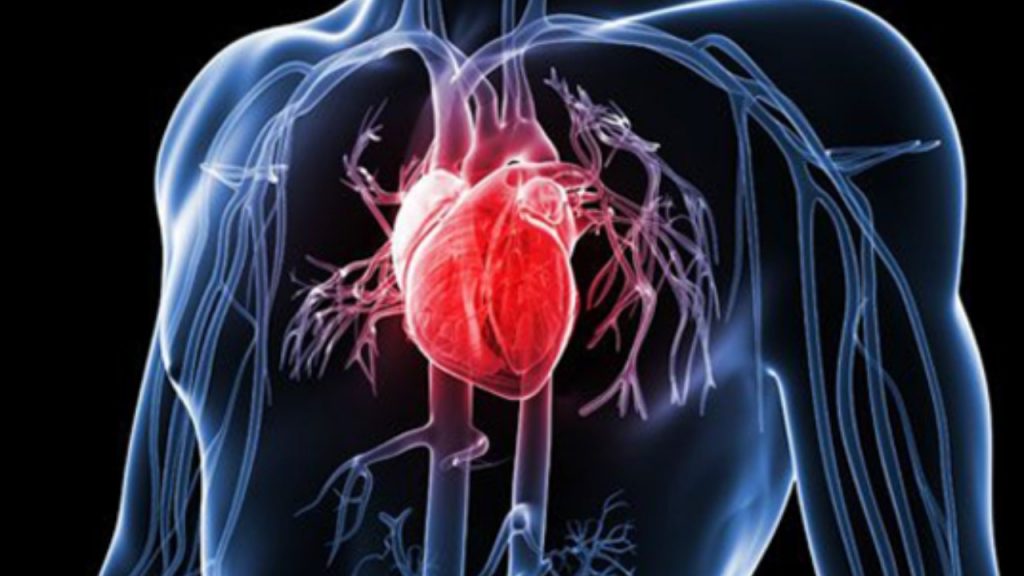 Heart Disease