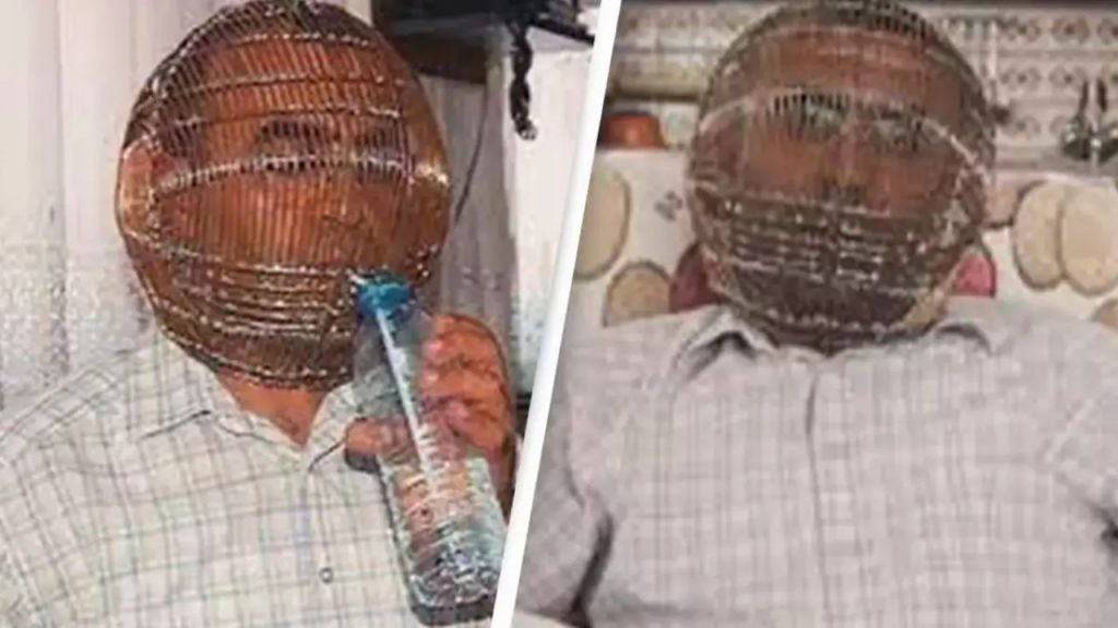Turkish Man Locked Head In Cage To Quit Smoking