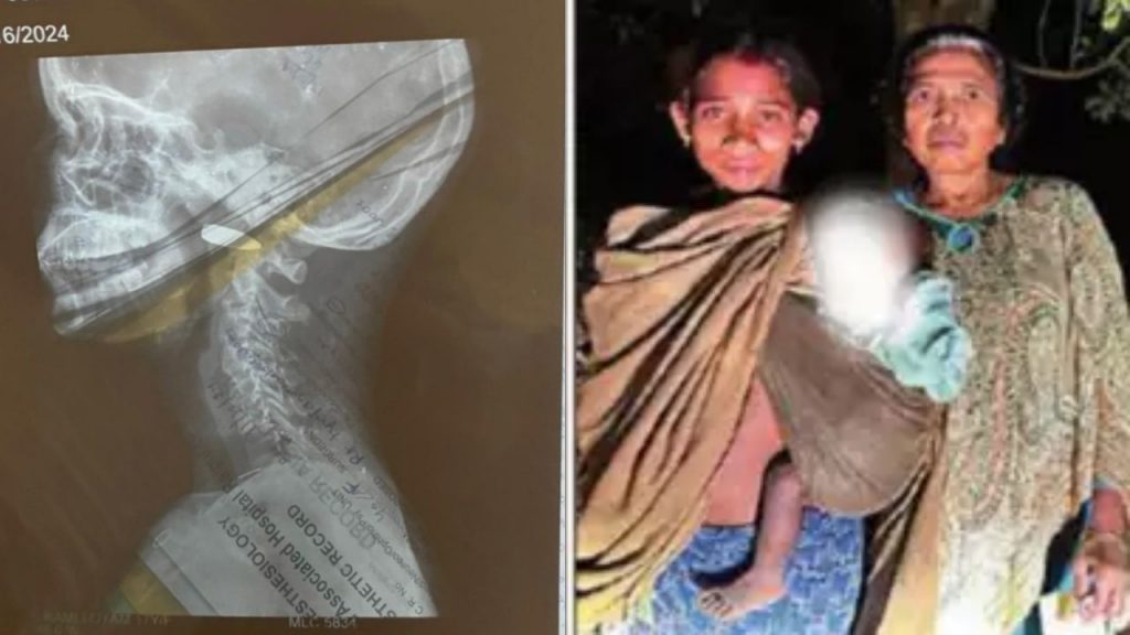 Innocent Victims Children Injured Chhattisgarh Abujhmarh Encounter