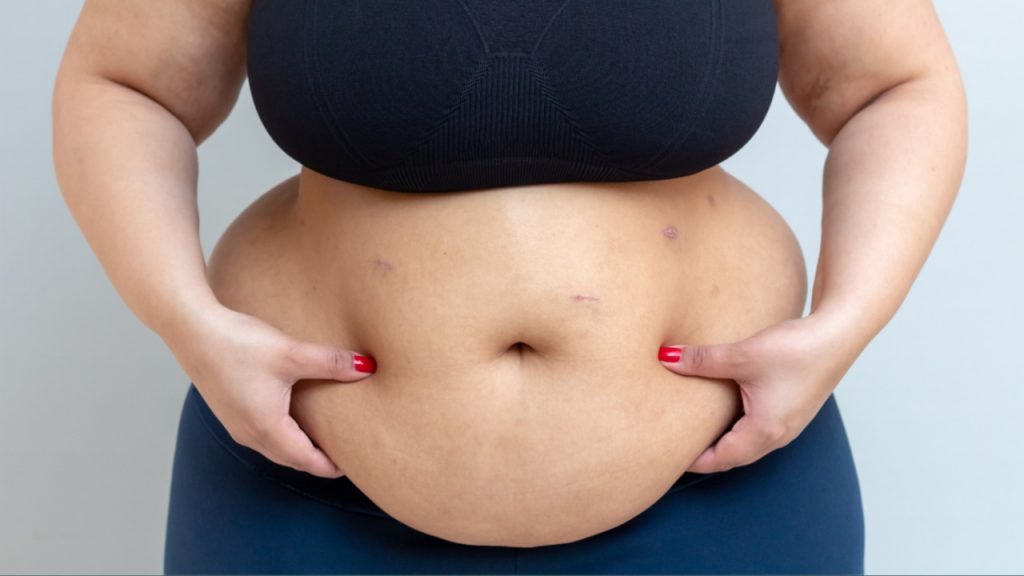 Belly Fat