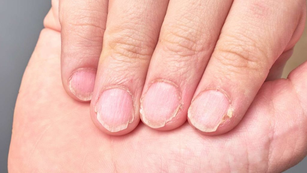 Nails Health