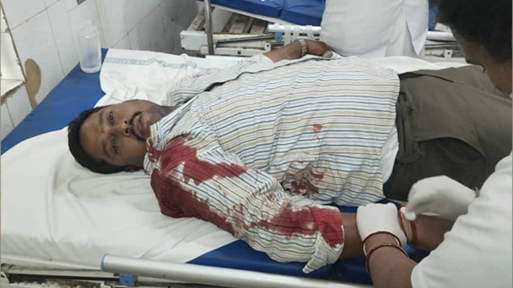 Man Was Attacked By A Leopa