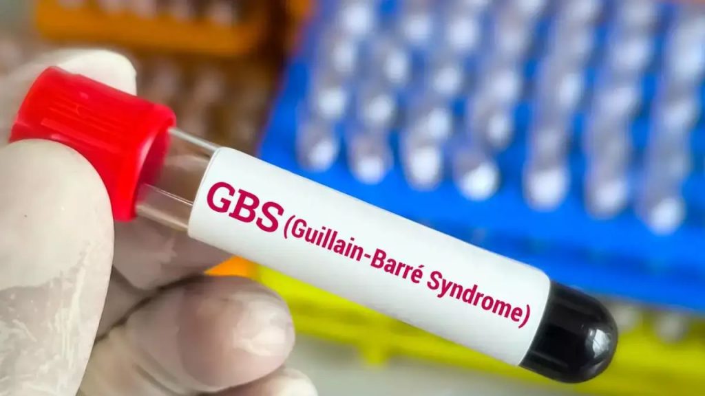 First Gbs Death Telangana Guillain Barré Syndrome