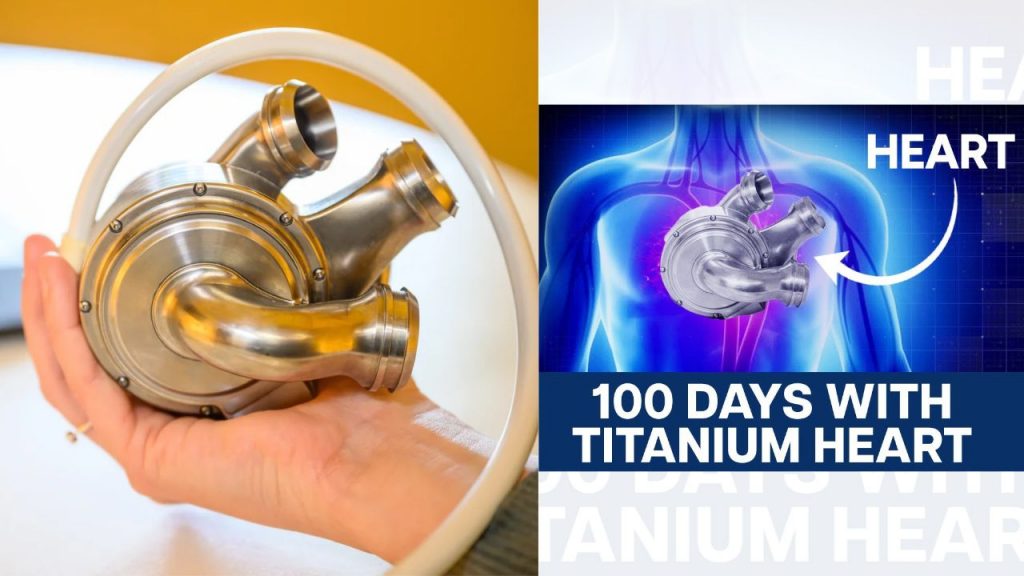 Artificial Titanium Heart Australian Man