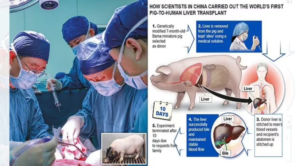 Chinese Doctors Pig Liver Into Humans China