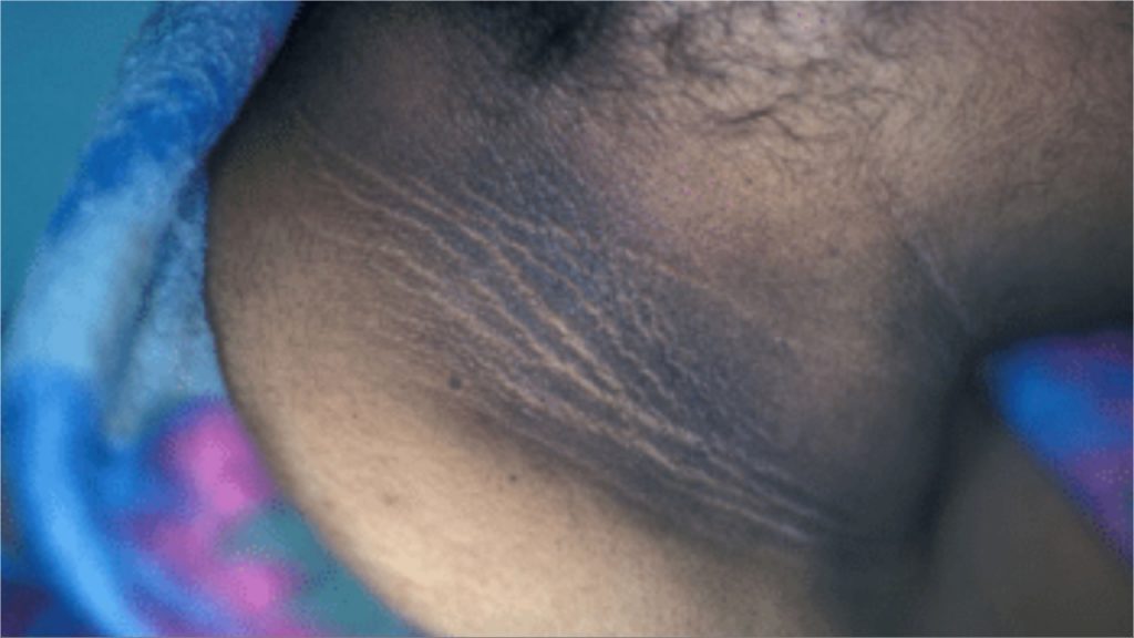 Dark Neck