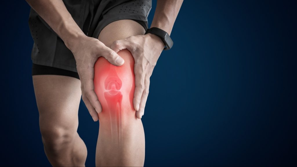 Arthritis