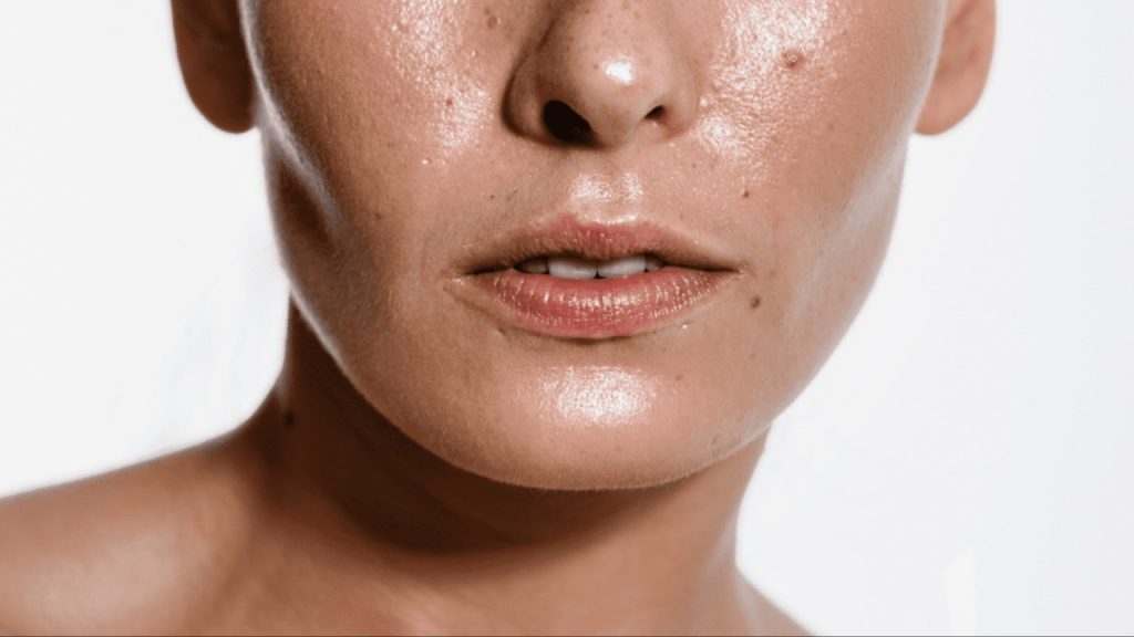 Oily Skin