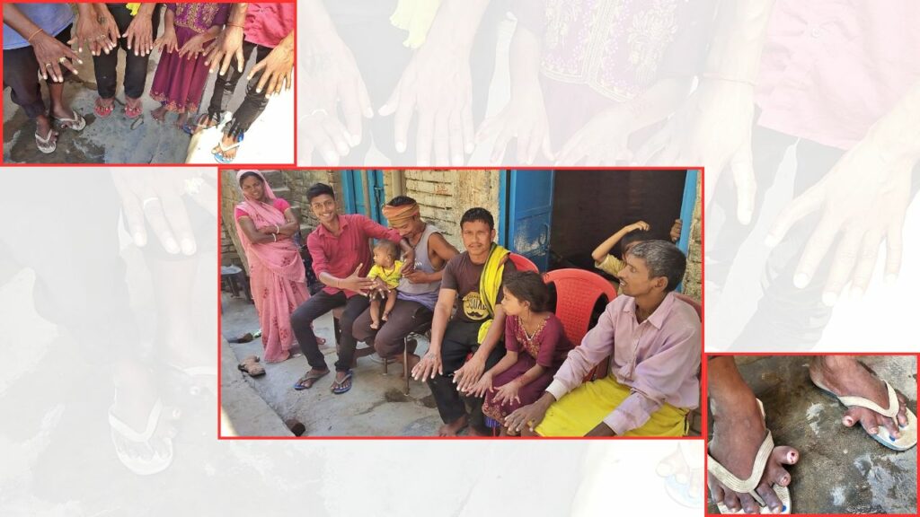 24 Fingers Family Bihari Family Bihar Gaya