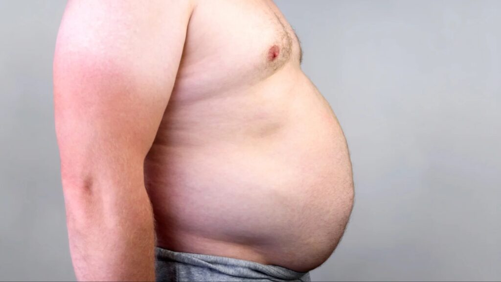 Belly Fat