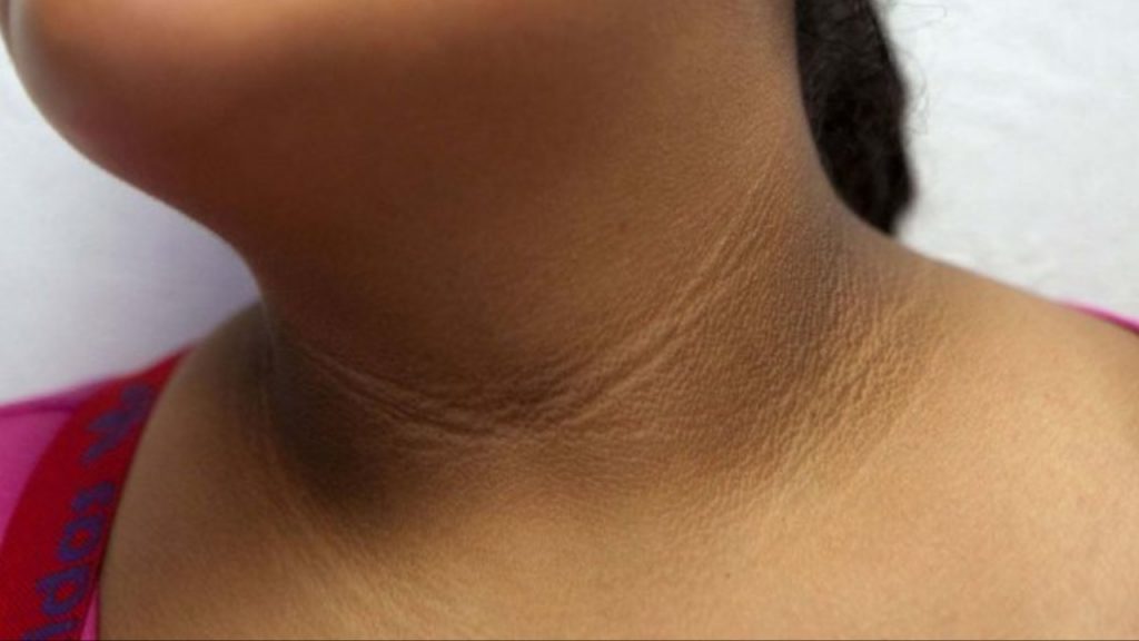 Black Neck
