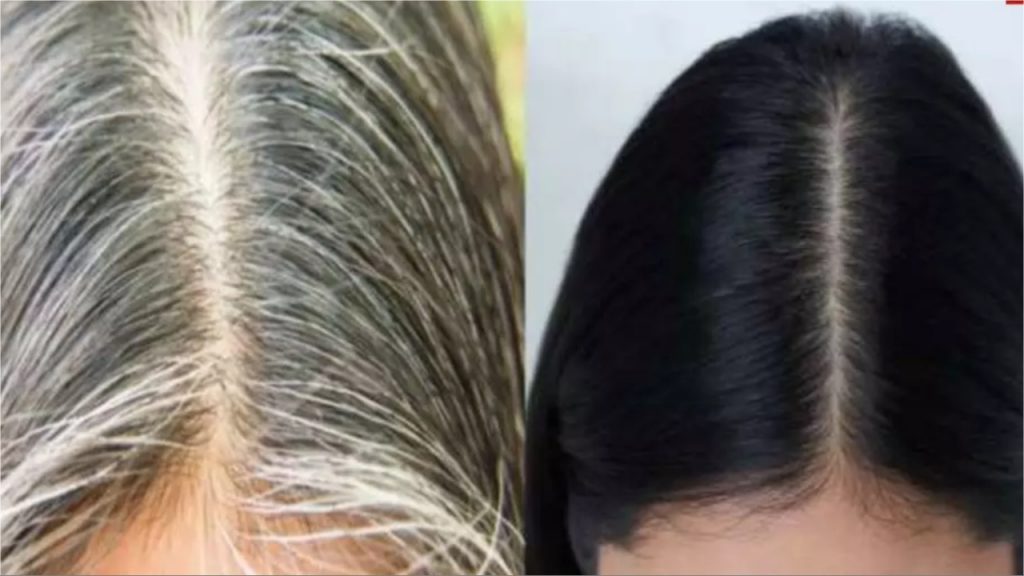 White Hair