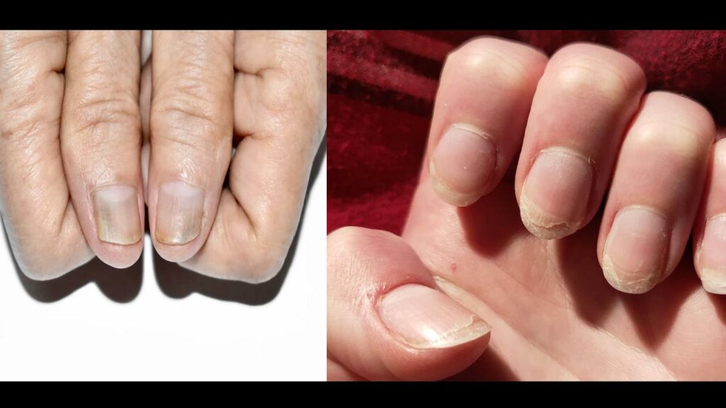 Nails Changing Color