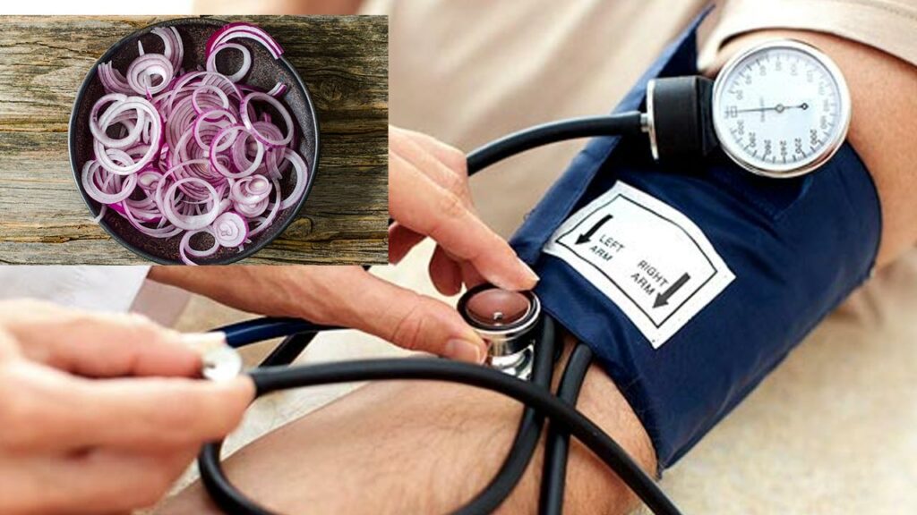 Onion Bp Control