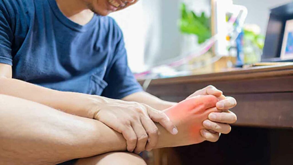 High Uric Acid