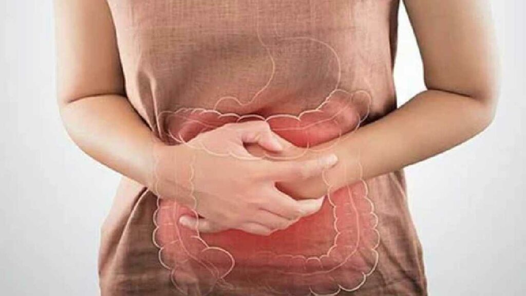 Gastric