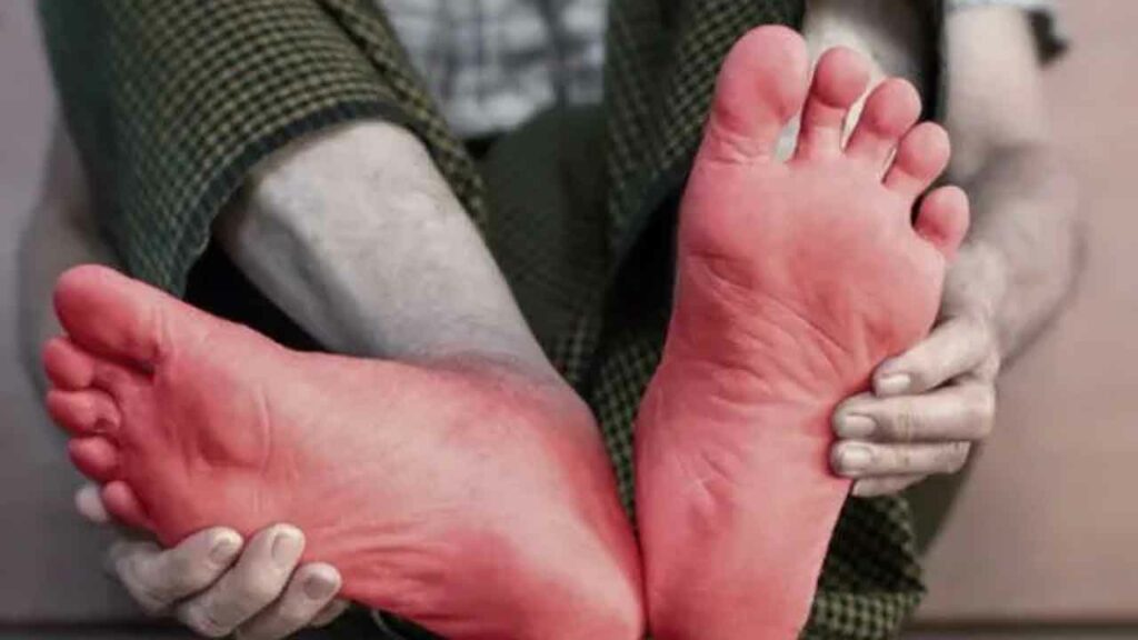 Pain In The Ankle