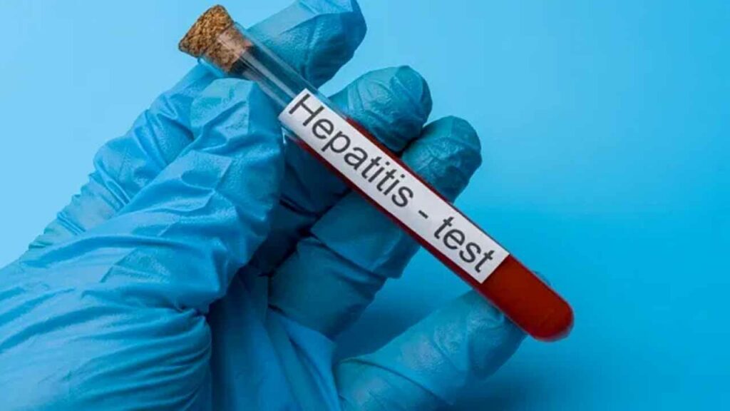 Why does hepatitis occur? Let's find out what to do to prevent it.
