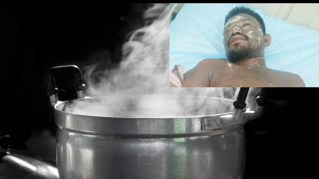 Wife Pours Boiling Water On